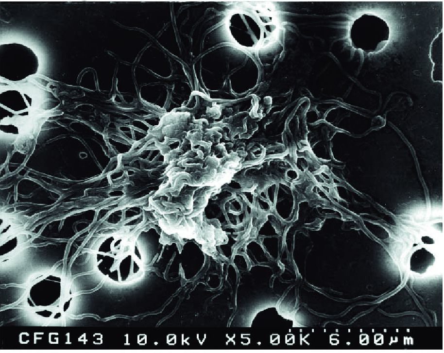 Антитела к borrelia burgdorferi. Боррелии под микроскопом. Боррелии фото под микроскопом.